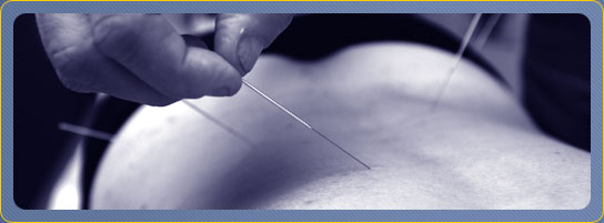 Services: Acupuncture